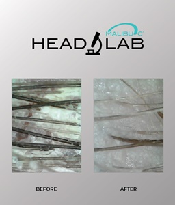 Malibu C Scalp Care Services