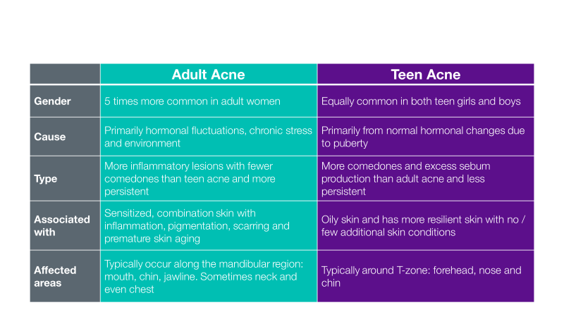 ch-treating-adult-acne